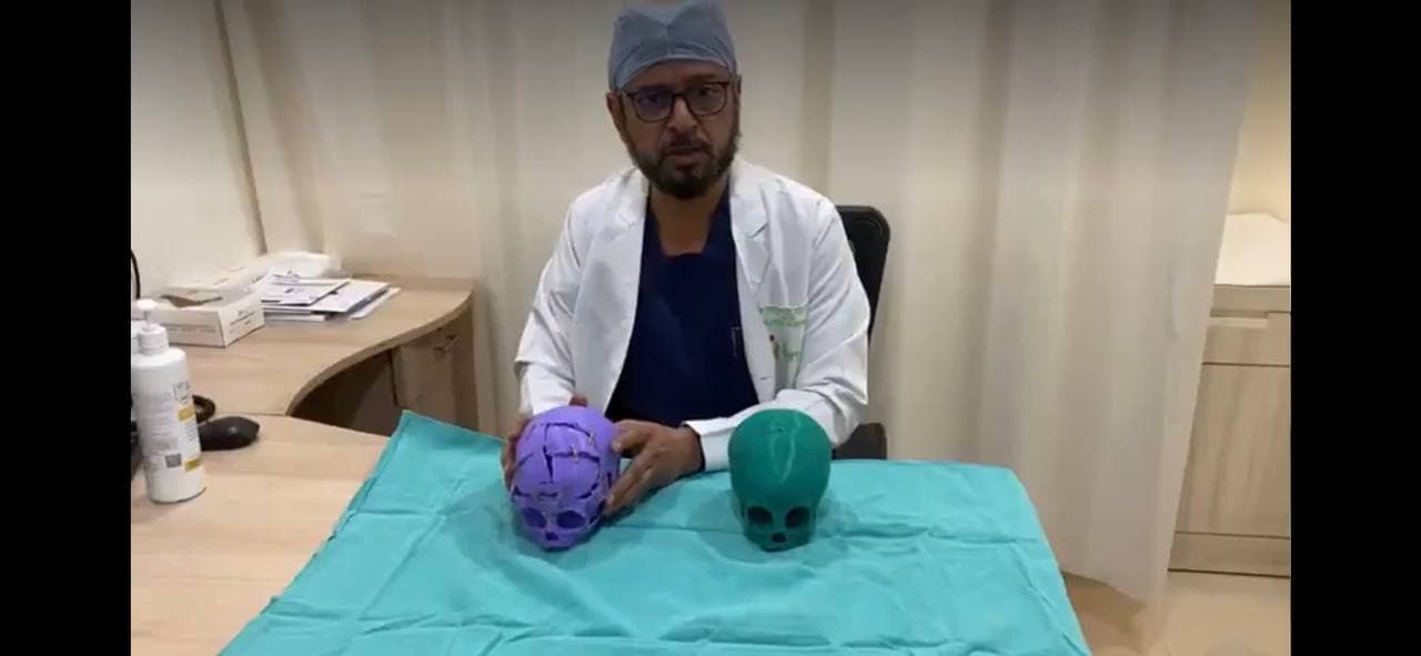 Autoabode 3D printed pre-surgical skull model for craniofacial surgery — Fortis Hospital case
