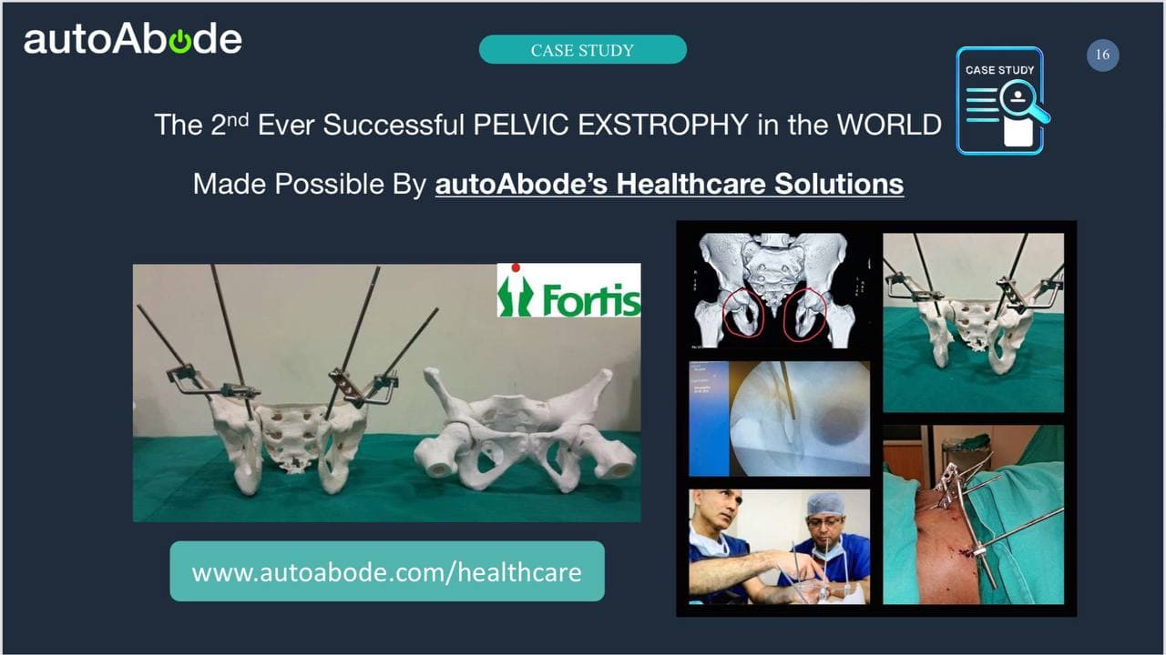 Autoabode high-precision 3D printed medical model — FDM printing for healthcare India